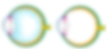 会員限定の図