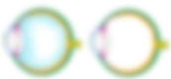 会員限定の図