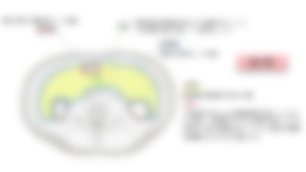 会員限定の図