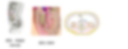会員限定の図