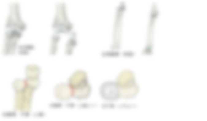 会員限定の図