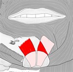 オトガイ筋