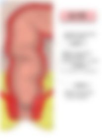 会員限定の図